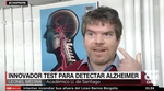 Trabajo de complejidad para identificación de Alzheimer destacado en CNN-Chile, Chilevisión y otros